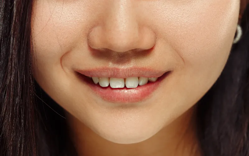 white-spots-inside-teeth