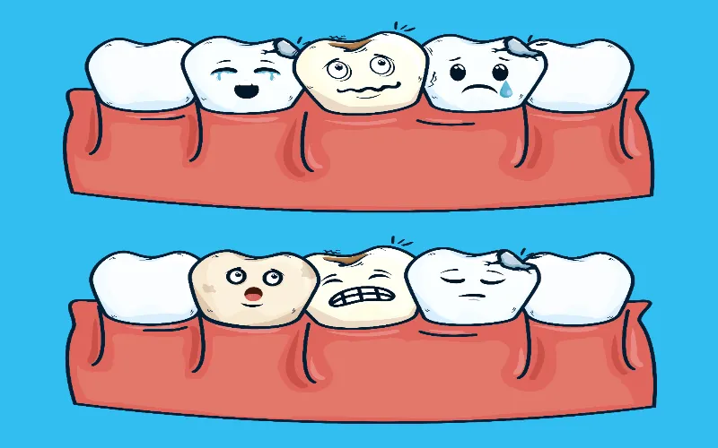 cavities-at-gum-line