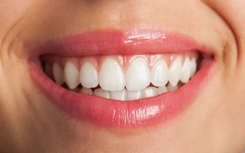 gingivitis-white-gums